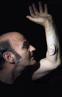 Stelarc